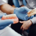 Preventing Shifting of Remaining Teeth: A Guide to Maintaining Dental Bridges