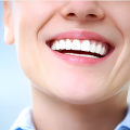 Restoring Oral Function: How Full Mouth Reconstruction Can Improve Your Quality of Life