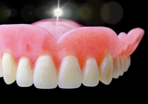 Understanding Dentures: Everything You Need to Know